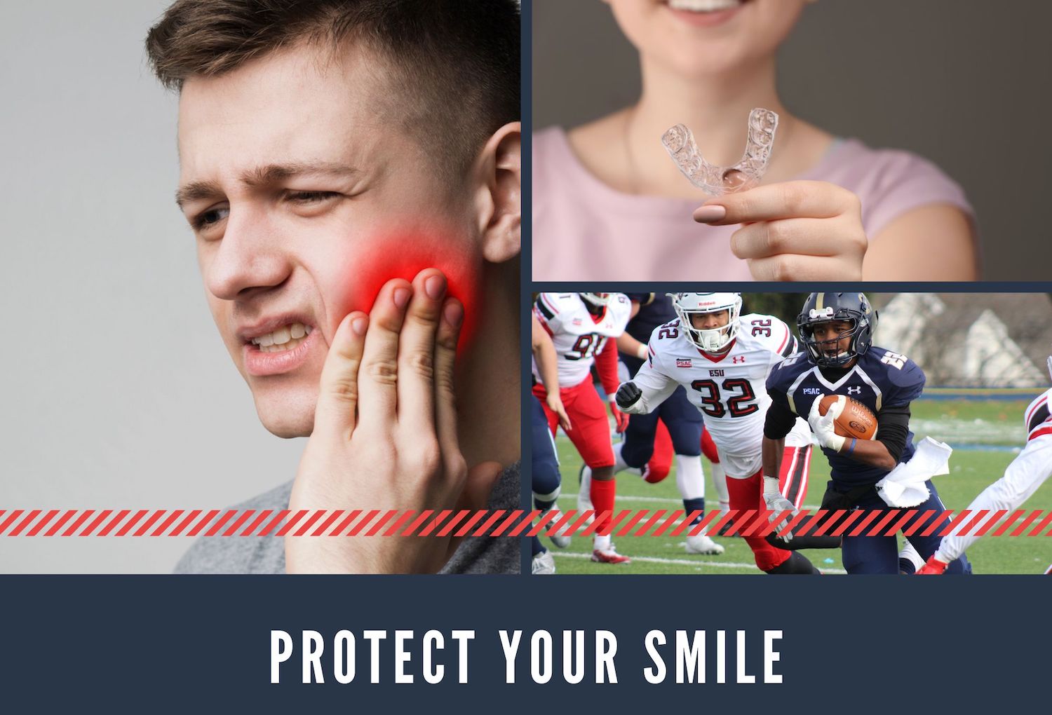 Mouthguards